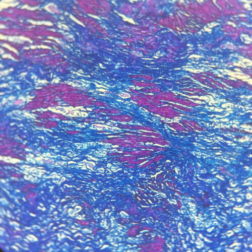 Artery Masson's trichrome stain - Image 2
