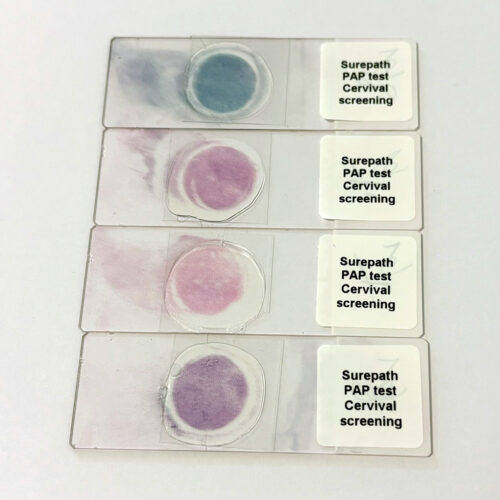 Cervical cancer screening tests, SurePath, PAP stain Preview