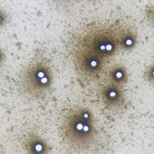 Cryptococcus neoformans
