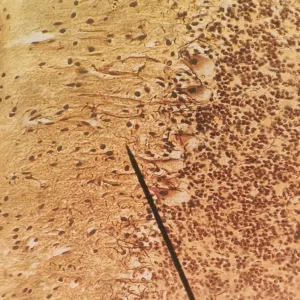 Purkinje cells silver stain
