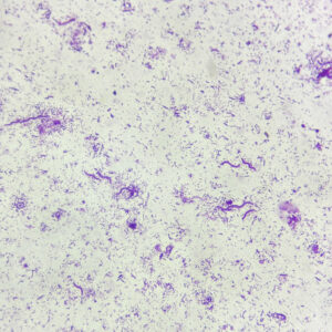 Bacteria Three Types slide (Cocci, Bacilli, Spirilla) Smear, Microbiology Prepared Slide