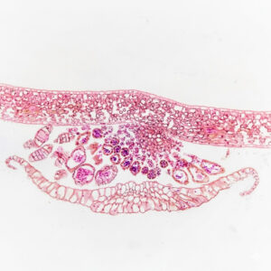 Fern Leaf Sorus C.S., Prepared Microscope Slides