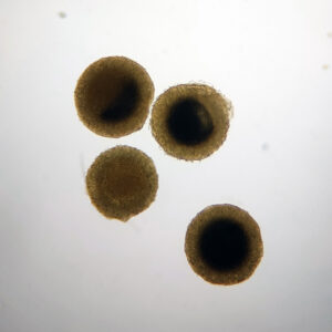 Freshwater Sponge Gemmules Whole Mount