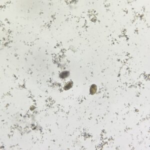 Paragonimus westermani Ova whole mount