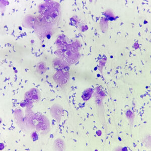 Toxoplasma gondii Tachyzoites