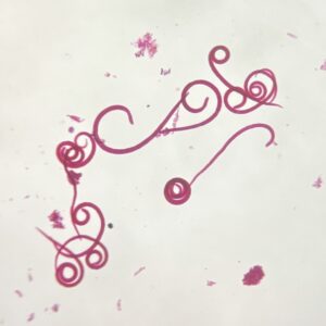 Trichinella Spiralis adult whole mount